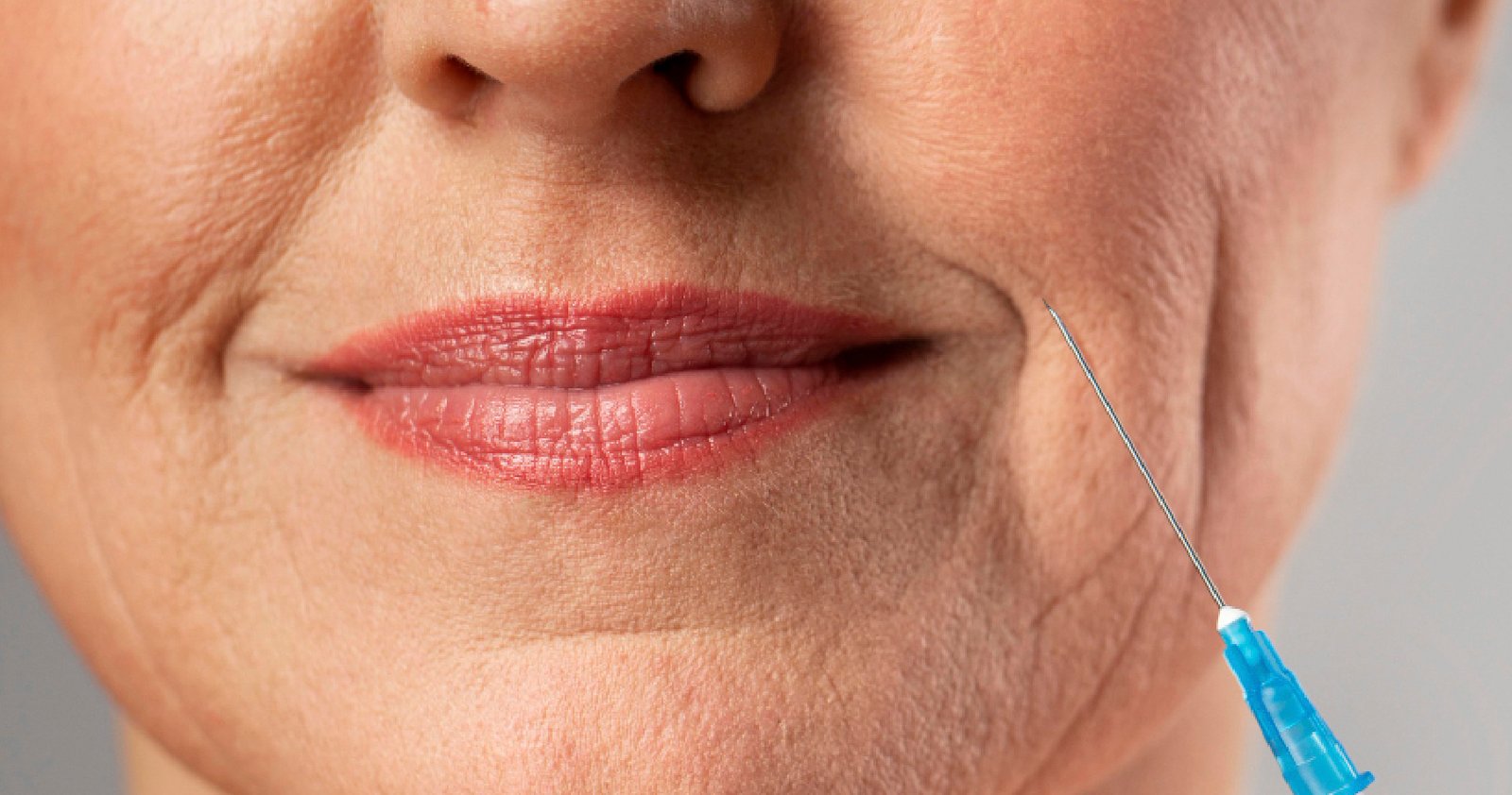 Anti-Aging Treatment In Bangalore